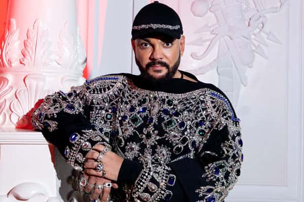 Киркоров признался, что сделал пластические операции ради новой любви