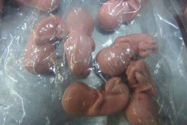 Женщину с 200 эмбрионами в чемодане задержали на российской таможне