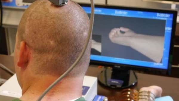 Человек с чипом в мозге смог управлять компьютерной мышью силой мысли