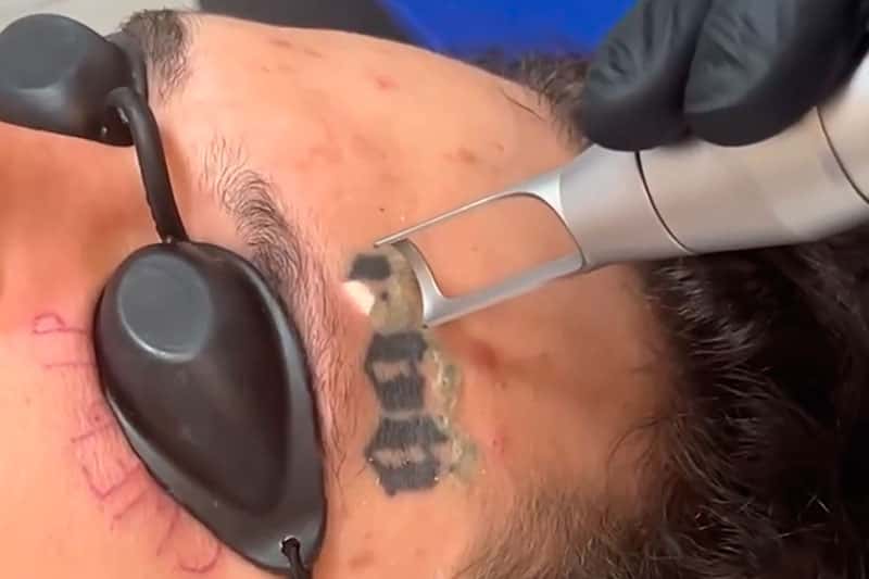 Алишер Моргенштерн* решает начать новую жизнь: рэпер удаляет татуировки с лица и все посты в Instagram**