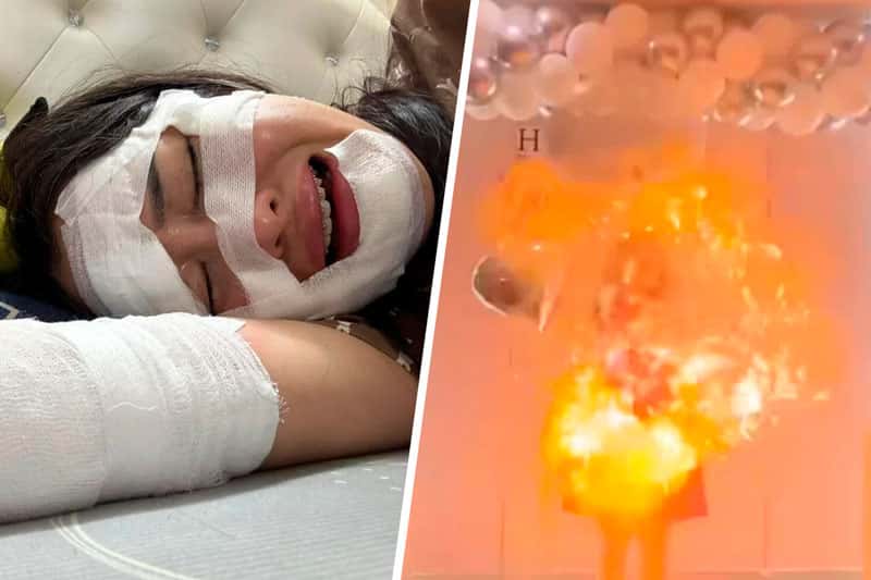 Во Вьетнаме женщина получила ожоги лица из-за взрыва шаров с водородом на дне рождения. Видео