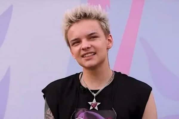 Зрение резко упало до минус 13 у блогера Егора Шипа