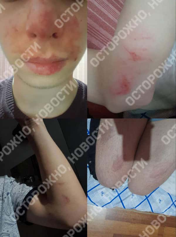 В Ингушетии пропал 16-летний подросток, которому родственники угрожали убийством чести