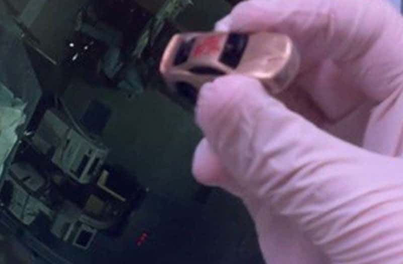 В Подмосковье врачи достали из желудка ребёнка игрушечную машинку