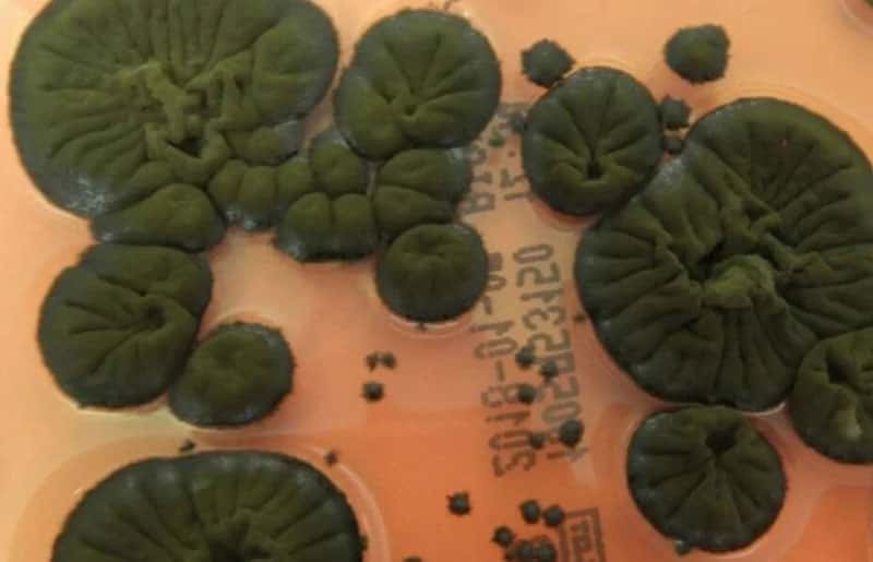 В Чернобыле нашли чёрный гриб, который растёт под воздействием радиации