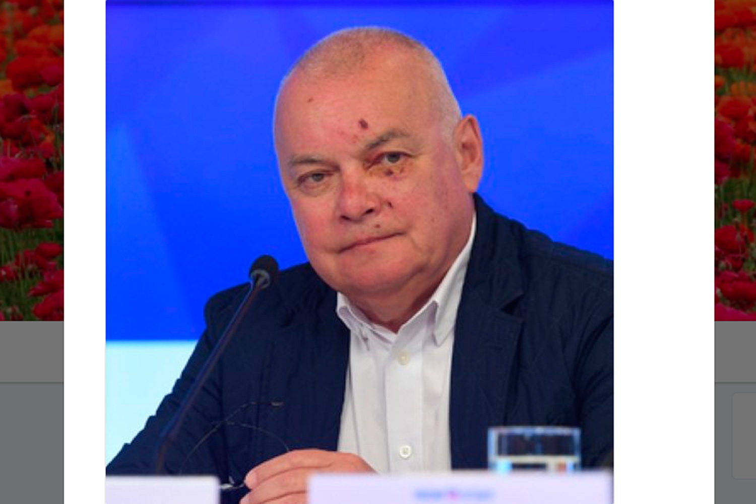 Телеведущий Дмитрий Киселев вернулся из Крыма с разбитым лицом. ФОТО