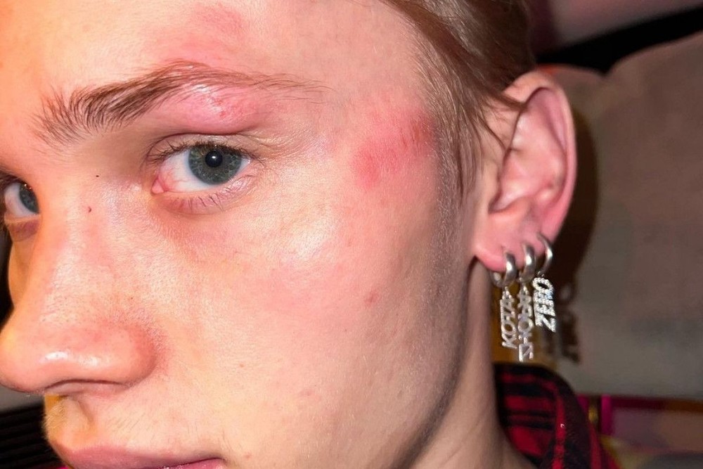 Тиктокера Даню Милохина сбил велосипедист в Москве