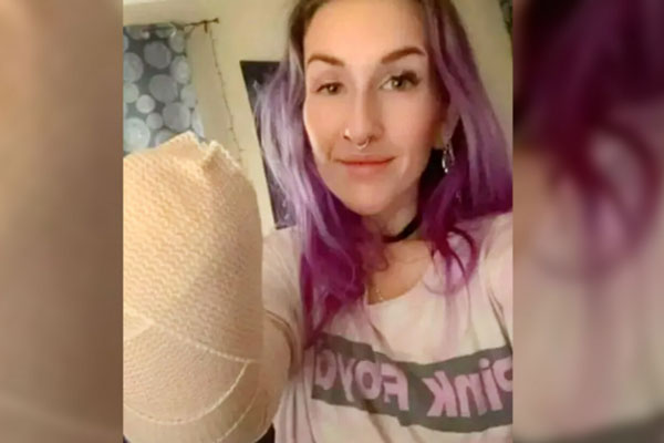 Женщине из Южной Каролины ампутировали руку из-за сильного ожога от фена | Девушка лишилась руки во время сушки волос феном