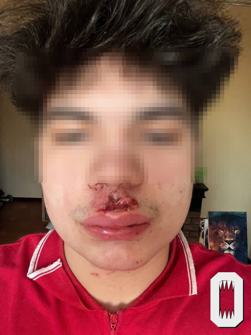 В Петербурге группа подростков потребовала у прохожего отдать им куртку или деньги