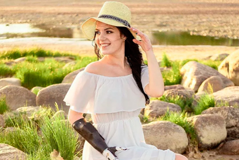 Россиянка, которой муж отрубил кисти, рассказала о новом женихе