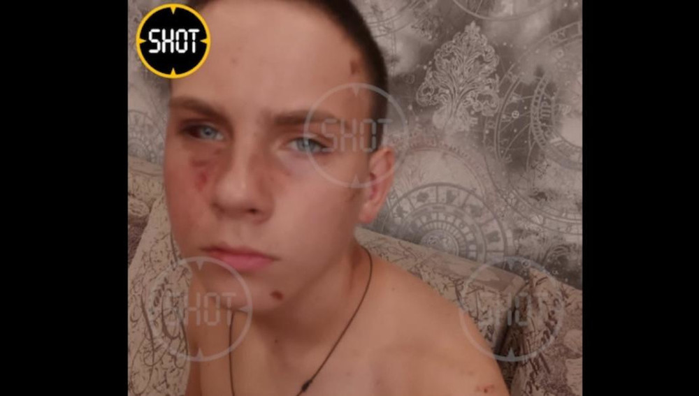 Полицейские из Волгограда жестоко избили 14-летнего подростка, приняв его за закладчика