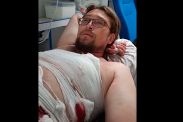 В Тамбовской области избили активиста, пожаловавшегося Путину