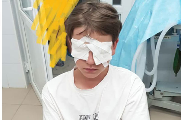 В Невинномысске мальчика госпитализировали после избиения в детском лагере