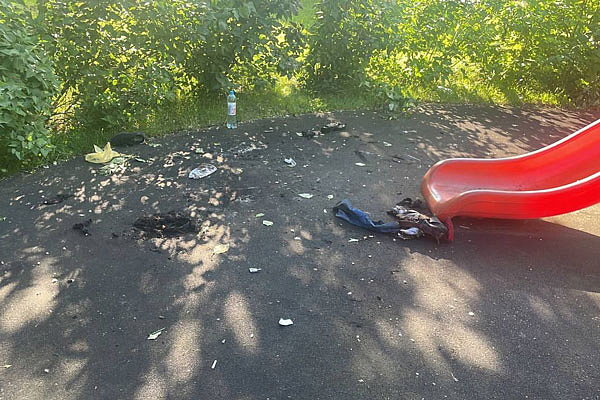 Подростку из Москвы, получившему во время игры с бензином ожоги почти всего тела, планируют вскрывать грудную клетку